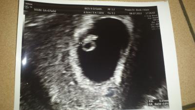 Bild zu Das erste US Bild vom 8.7 und ein kleiner Tagesbericht - Forum für Februar - Mamis