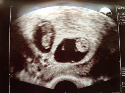 Bild zu auch zurück vom FA :-) - Forum für Februar - Mamis