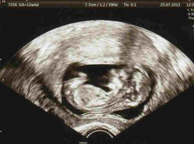 Bild zu zurück vom FA - Forum für Februar - Mamis