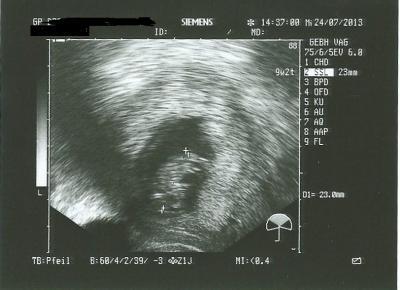 Bild zu Zurück vom FA - Forum für Februar - Mamis