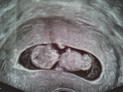 Bild zu FA-Besuch - Forum für Februar - Mamis