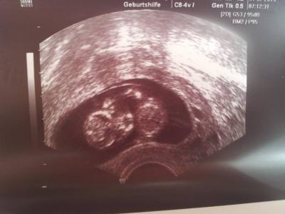 Bild zu zurück vom Doctor! - Forum für Februar - Mamis