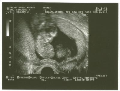 Bild zu zurück vom FA +Bild - Forum für Februar - Mamis
