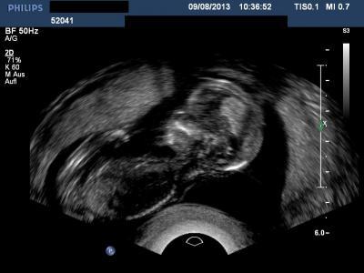 Bild zu Zurück vom FA Termin zur NFM (sorry lang aber auch unglaublich) + Bild - Forum für Februar - Mamis
