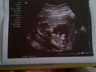Bild zu zurück vom FÄ... :) - Forum für Februar - Mamis