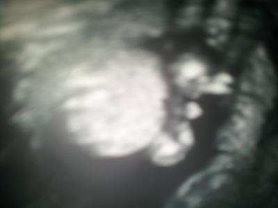 Bild zu 20. Ssw - Forum für Februar - Mamis
