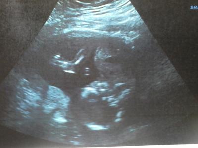 Bild zu Zurück vom FA Termin - Forum für Februar - Mamis