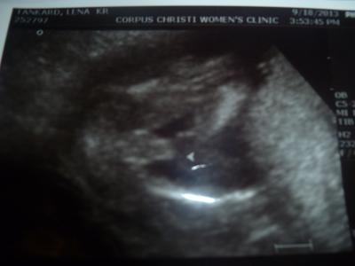 Bild zu Mein kleiner Sohn bekommt.... - Forum für Februar - Mamis