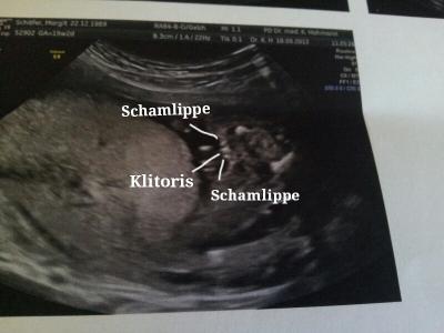 Bild zu Outingbild - Forum für Februar - Mamis