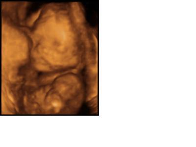 Bild zu FA-Termin und verwirrt - Forum für Februar - Mamis
