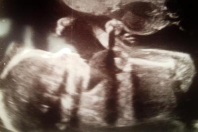 Bild zu Verspäteter FA Bericht - Forum für Februar - Mamis