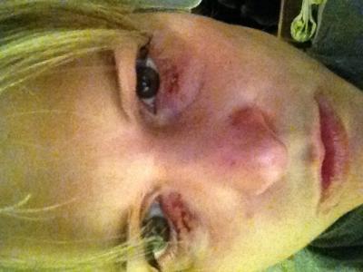 Bild zu Verspätetes Helloween :-((( - Forum für Februar - Mamis