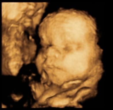Bild zu 3D-Schall - ich bin hin und weg :-) - Forum für Februar - Mamis