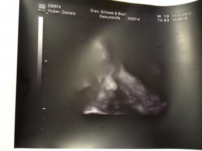 Bild zu vorgezogene VU 3 gestern - Forum für Februar - Mamis