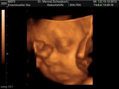 Bild zu darf vorstellen - Forum für Februar - Mamis