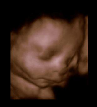 Bild zu 3. großer Ultraschall - Forum für Februar - Mamis