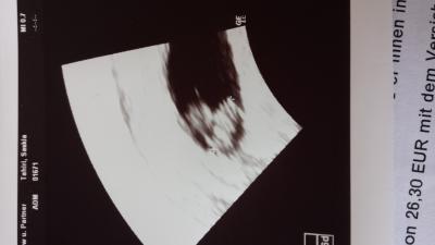 Bild zu Ich möchte meinen Krümel auch vorstellen! - Forum für Februar - Mamis