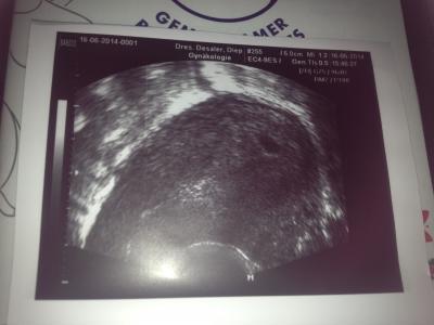 Bild zu Außerplanmäßig bei Frauenarzt gewesen und jetzt irritiert :/ - Forum für Februar - Mamis