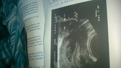 Bild zu Mein Bericht - Forum für Februar - Mamis