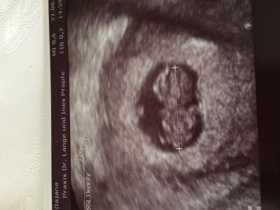 Bild zu Heute auch FATermin und Ultraschall - Forum für Februar - Mamis