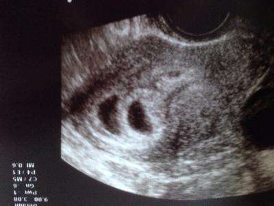 Bild zu Zurück vom 2. US - Forum für Februar - Mamis