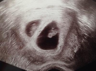 Bild zu Ungeplanter FA Termin - Forum für Februar - Mamis