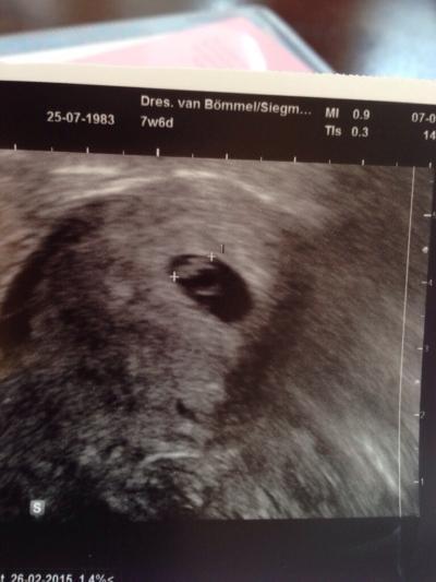 Bild zu 9 Tage zurück gesetzt - Forum für Februar - Mamis