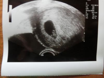Bild zu Neu hier... - Forum für Februar - Mamis