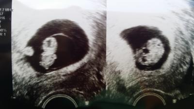 Bild zu FA Besuch :) und Bildchen - Forum für Februar - Mamis