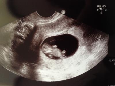 Bild zu Mir ist ein Felsbrocken vom Herzen gefallen - Forum für Februar - Mamis
