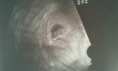 Bild zu Wieder da ... :) - Forum für Februar - Mamis