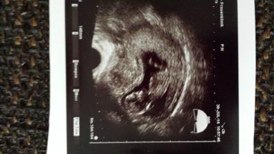 Bild zu Auch mal wieder melden. ... - Forum für Februar - Mamis