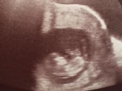 Bild zu Erleichterung, Freude und Aufregung! - Forum für Februar - Mamis