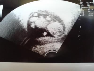 Bild zu So verliebt! :) - Forum für Februar - Mamis