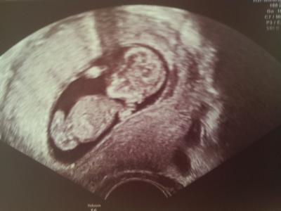 Bild zu Zurück - Forum für Februar - Mamis