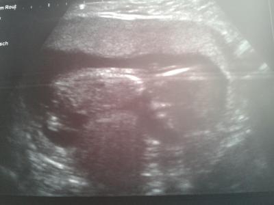 Bild zu Wuhu :-) - Forum für Februar - Mamis