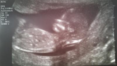 Bild zu Bericht vom FA gestern (sorry für die Verspätung) - Forum für Februar - Mamis