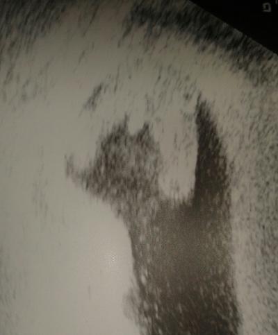 Bild zu Komme gerade aus dem Kh - Forum für Februar - Mamis
