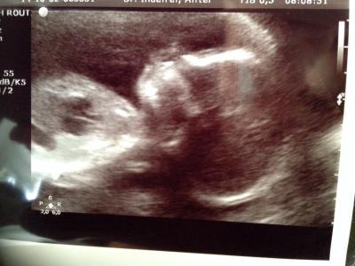 Bild zu Zurück vom Organscreening - Forum für Februar - Mamis