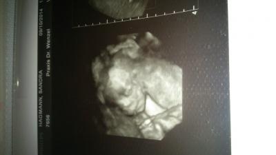 Bild zu Zurück vom Termin mit 3D Bild - Forum für Februar - Mamis