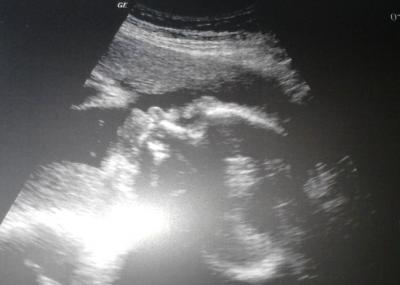 Bild zu Zurück vom 3. Screening - Forum für Februar - Mamis