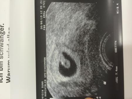 Bild zu Auch Fa-Bericht :) - Forum für Februar - Mamis