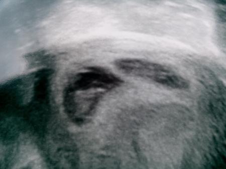 Bild zu Tatsächlich Zwillinge - Forum für Februar - Mamis