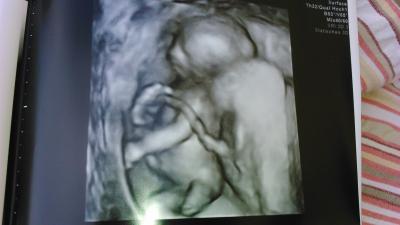Bild zu Unser Schnuckelchen - Forum für Februar - Mamis