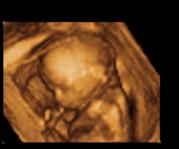 Bild zu Spontaner Ultraschall :-) - Forum für Februar - Mamis