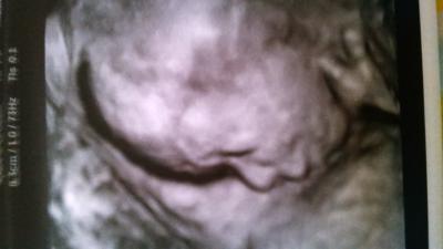 Bild zu Zurück vom Doc - Forum für Februar - Mamis