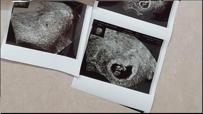 Bild zu Das warten hat ein Ende! - Forum für Februar - Mamis