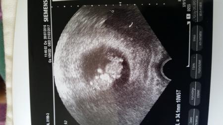 Bild zu erleichtert :) - Forum für Februar - Mamis
