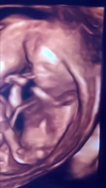 Bild zu Unerwarteter US - Forum für Februar - Mamis