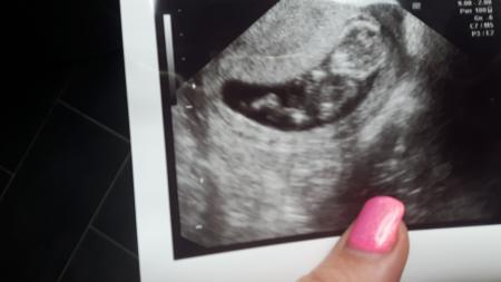 Bild zu So verliebt ... - Forum für Februar - Mamis